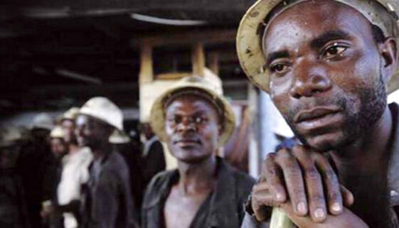 Silicosis