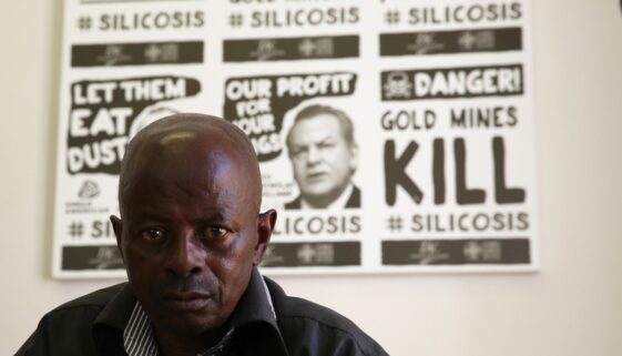 Silicosis